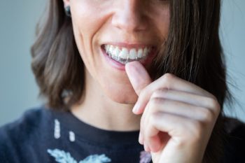 Beautiful Smile And White Teeth Of A Young Woman