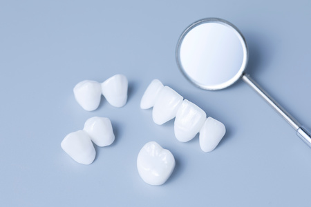 Veneers Lake Oswego OR