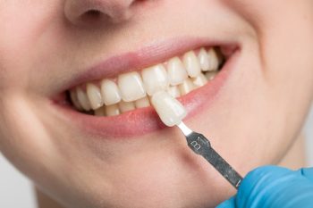 Dentist Using Shade Guide At Woman's Mouth To Check Veneer Of Tooth