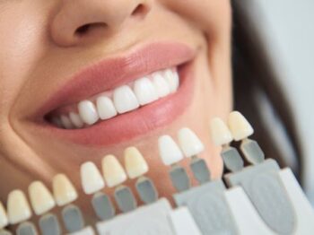 Teeth Whitening Near Me Lake Oswego Or