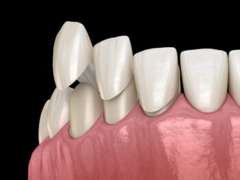 Dentist Lake Oswego OR