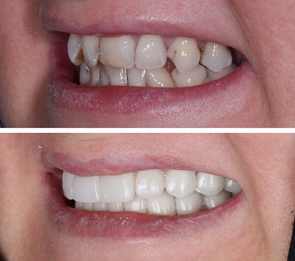 Dentist Near me Portland Oregon