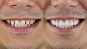 Dentist Portland Oregon