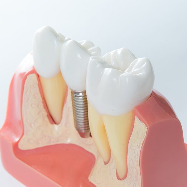 Dentist In Portland Or Near Me