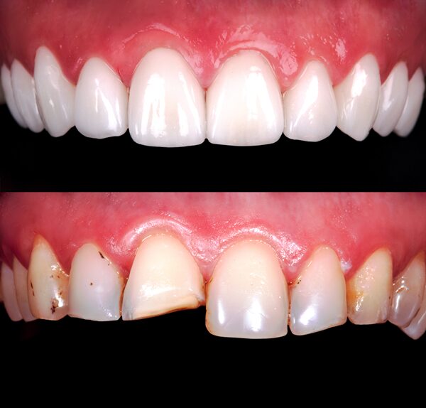 Dentist Near Me Lake Oswego OR