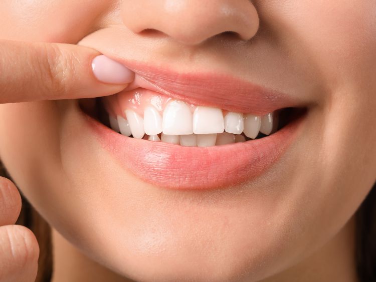 Teeth Cleaning Near Me