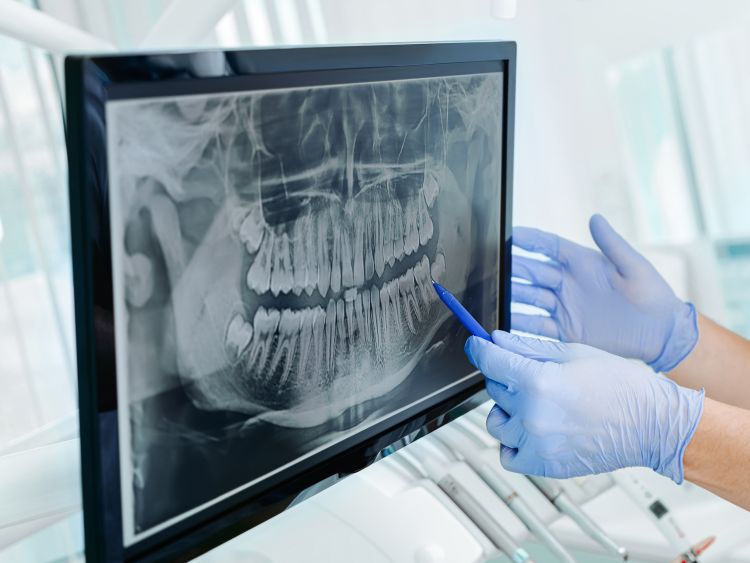 Brio Dental Is A Known Specialist Of Airway Dentistry Near West Linn Or